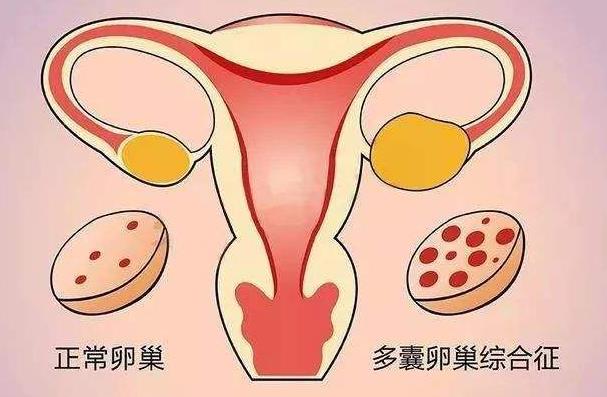 女性有慢性肝炎可以做试管婴儿吗，肝炎患者试管助孕的准备及治疗方法